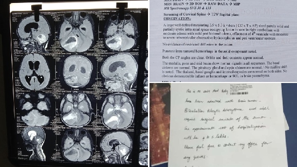 GV Prakash Kumar donates money for a one year old infant baby