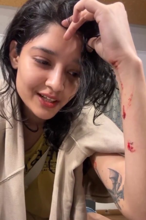 Actress Ritika singh injured in Thalaivar 170 shooting spot during fight scene