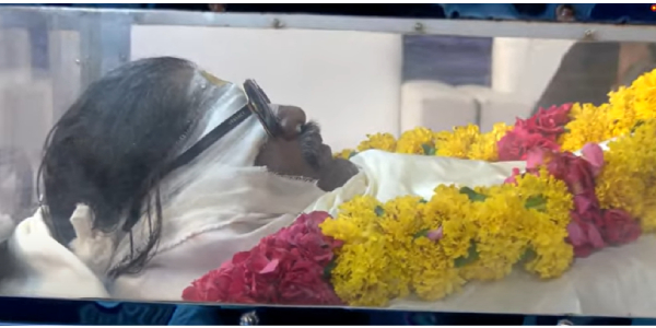 Daniel Balaji eye surface covered with cotton after eye donation process done