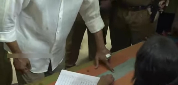 Vijay injured in his hand reveals after he cast his vote upsets fans