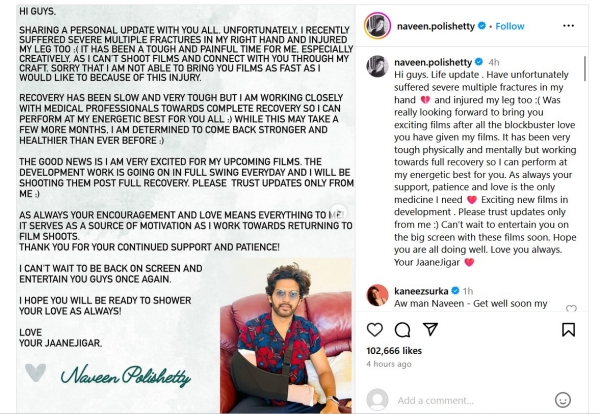 Naveen Polishetty accident Anushka Shetty