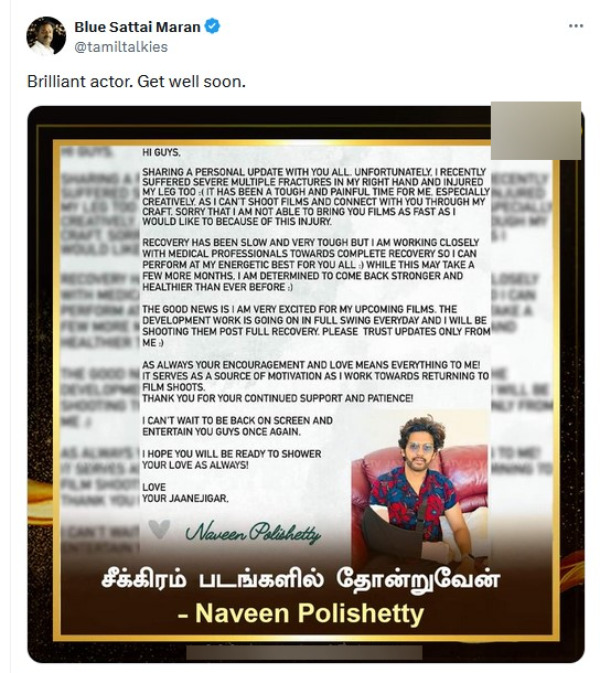 Naveen Polishetty accident Anushka Shetty