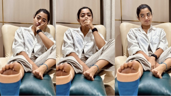 rashmika mandanna leg injury