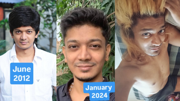 Maanagaram Actor Sri s current condition and wrong route shocks fans