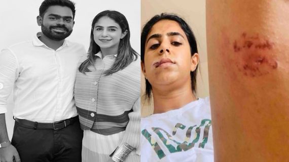 ప్రియుడి చిత్రహింసలు... బెడ్ నిండా రక్తం, గాయాలతో నటి షాకింగ్ పోస్ట్.. కాపాడాలంటూ