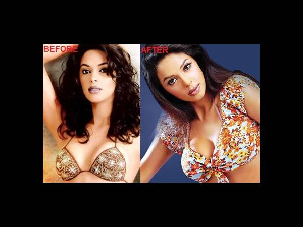 హాట్ హీరోయిన్స్... ఎక్కడెక్కడో సర్జరీలు(ఫోటోలు)