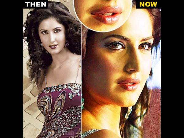 హాట్ హీరోయిన్స్... ఎక్కడెక్కడో సర్జరీలు(ఫోటోలు)