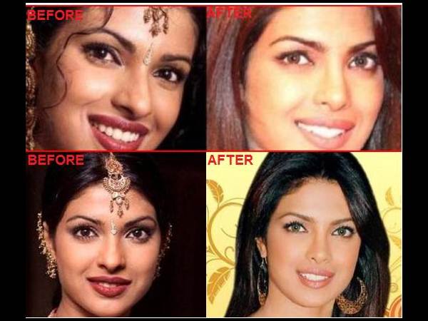 హాట్ హీరోయిన్స్... ఎక్కడెక్కడో సర్జరీలు(ఫోటోలు)