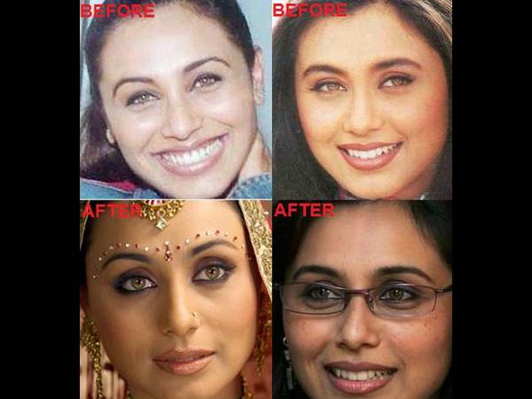 హాట్ హీరోయిన్స్... ఎక్కడెక్కడో సర్జరీలు(ఫోటోలు)