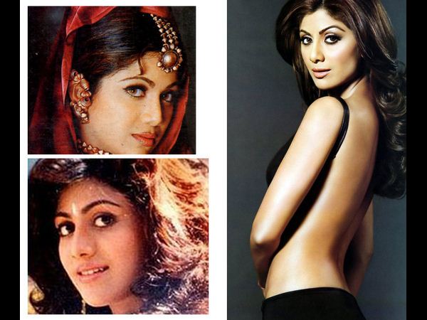 మన హీరోయిన్స్... సర్జరీ అందాలు ఇవే... (ఫోటో ఫీచర్)