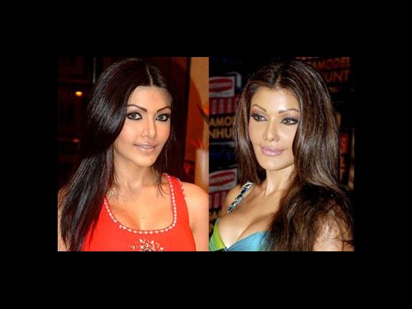 మన హీరోయిన్స్... సర్జరీ అందాలు ఇవే... (ఫోటో ఫీచర్)