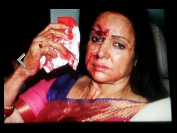 ప్రాతినిధ్యం