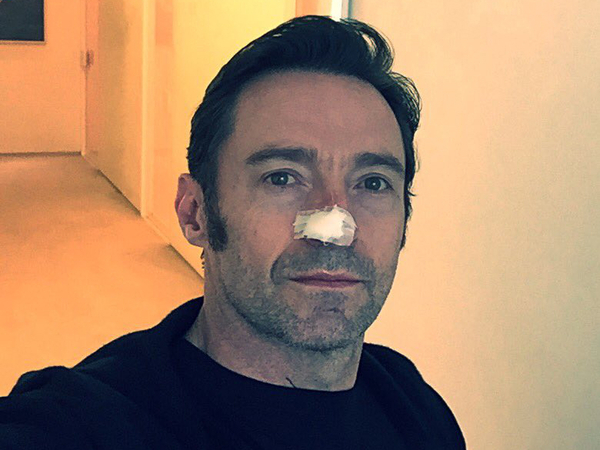Hugh Jackman Confirms About His Cancer Via Instagram Hugh Jackman Confirms About His Cancer Via Instagram