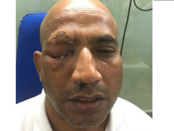 ప్రమాదకరమైన అటవీ ప్రాంతం