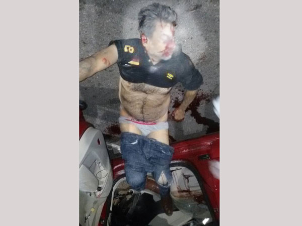 ఉస్మానియా ఆసుపత్రిలో