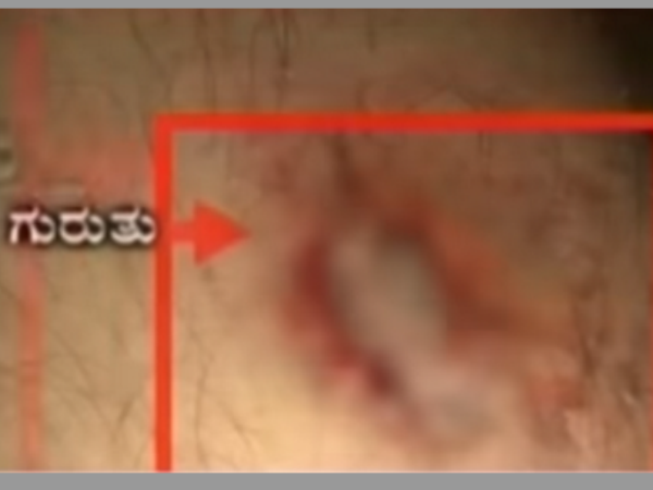 ఆత్మహత్యకు యత్నించి