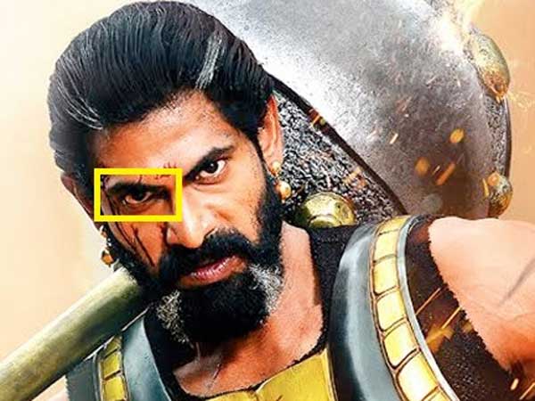 కంటిలో చూపులేదు. 