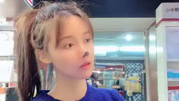 ఇన్ఫెక్షన్ కారణంగా