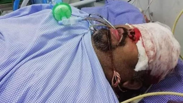 నెల్లూరులో రోడ్డు ప్రమాదం