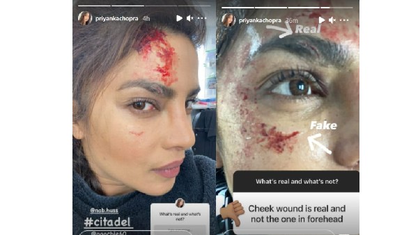 నిజమైన గాయాలు కావు 