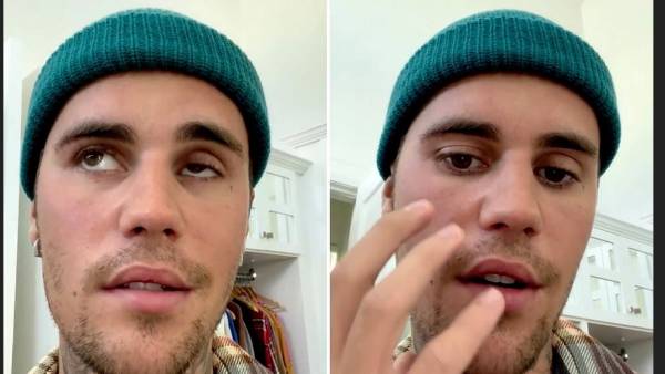 నాకు రామ్సే హంట్ సిండ్రోమ్