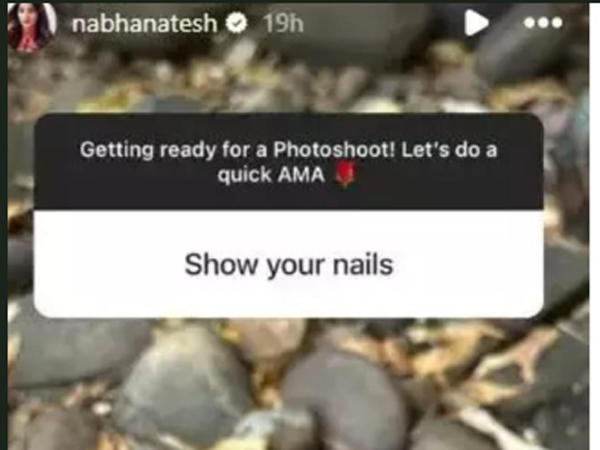 Netizen Unexpected Request To Heroine Nabha Natesh