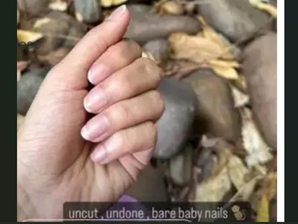 Netizen Unexpected Request To Heroine Nabha Natesh