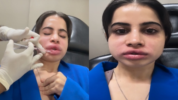 Bigg Boss fame urfi javed surgery gone wrong Here s the details