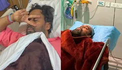 Bosco Martis Health Update: Choreographer Admitted To Hospital. His Latest Pics Leave Fans Worried