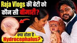 Raja Vlogs Daughter Health Rumours Explained | What Is Hydrocephalus And Why Is It Trending?