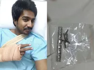 Actor Vishnu Is A Free Man After Removing Metal Plate From His Hand!