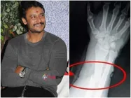 ದರ್ಶನ್ ಸ್ಥಿತಿ ಈಗ ಹೇಗಿದೆ?: ಆಸ್ಪತ್ರೆಯಿಂದ ಇಂದು ಡಿಸ್ಚಾರ್ಜ್ ಆಗಲ್ಲ 